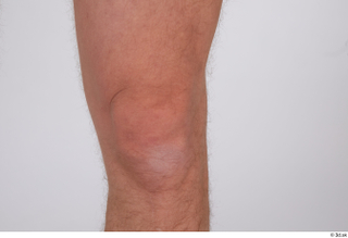 Arvid knee nude 0003.jpg